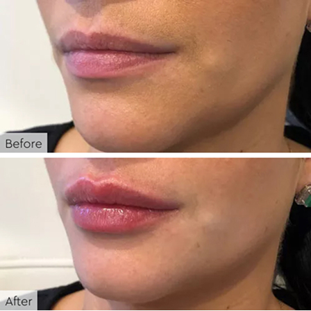 76efc376f2aa93b1a49312c24a370f5350e51b1c