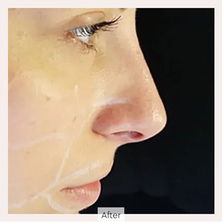 8da3c618388ee913d949e7ec08d05fc292f0f81e