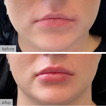 c4915087de02b2611a005f1cd5fad1ee94d21d67