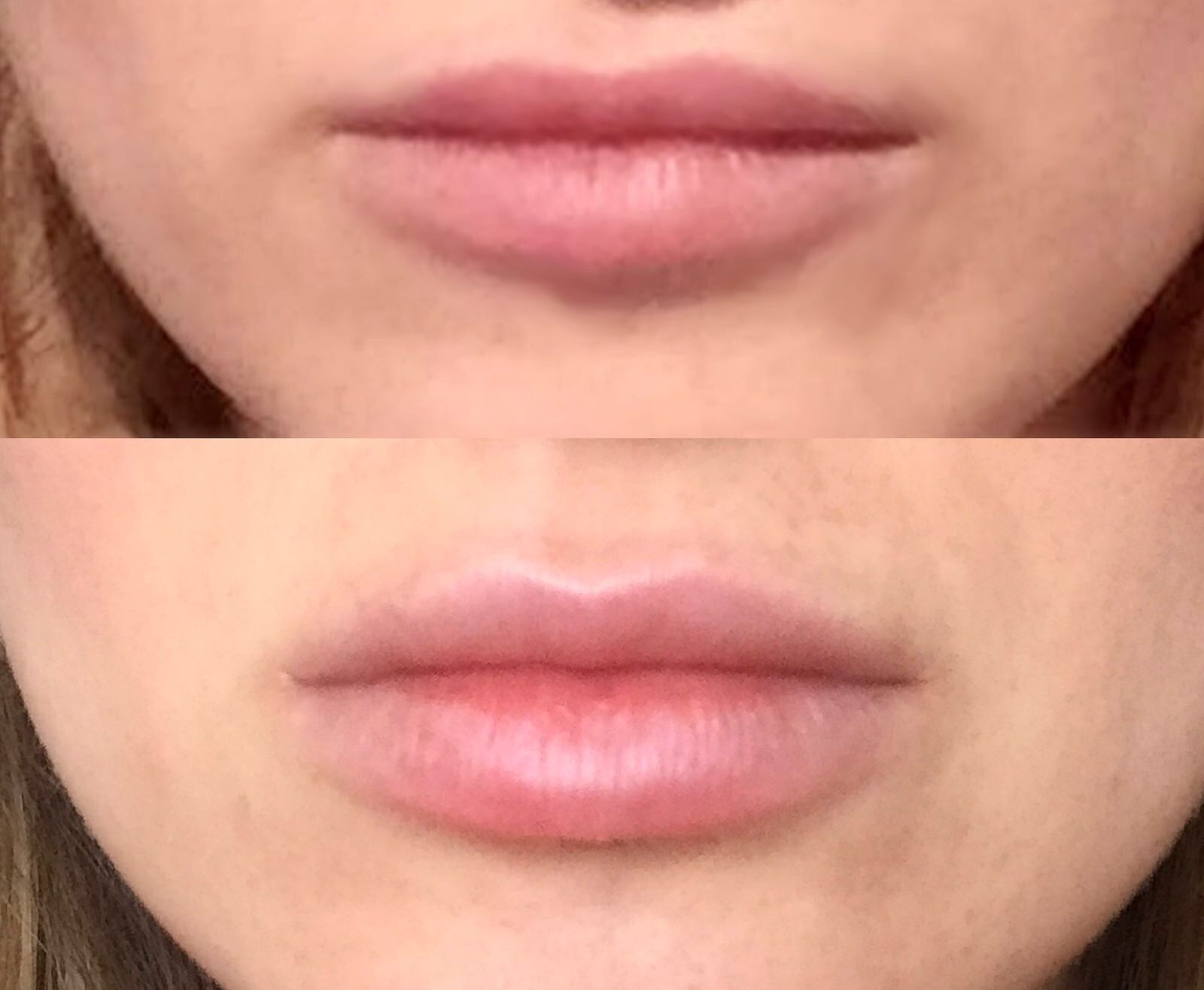 Client 1