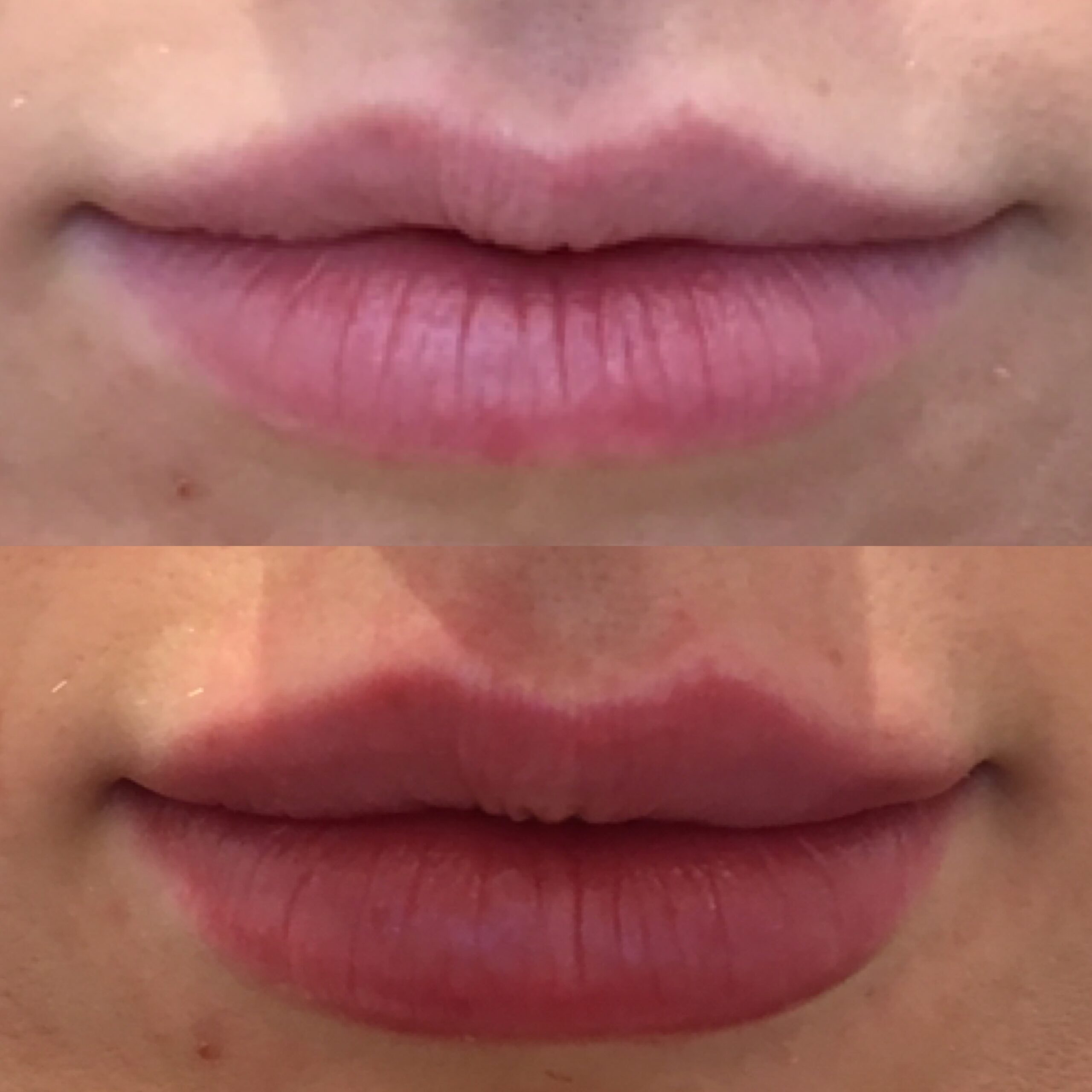 Stacey lips 1